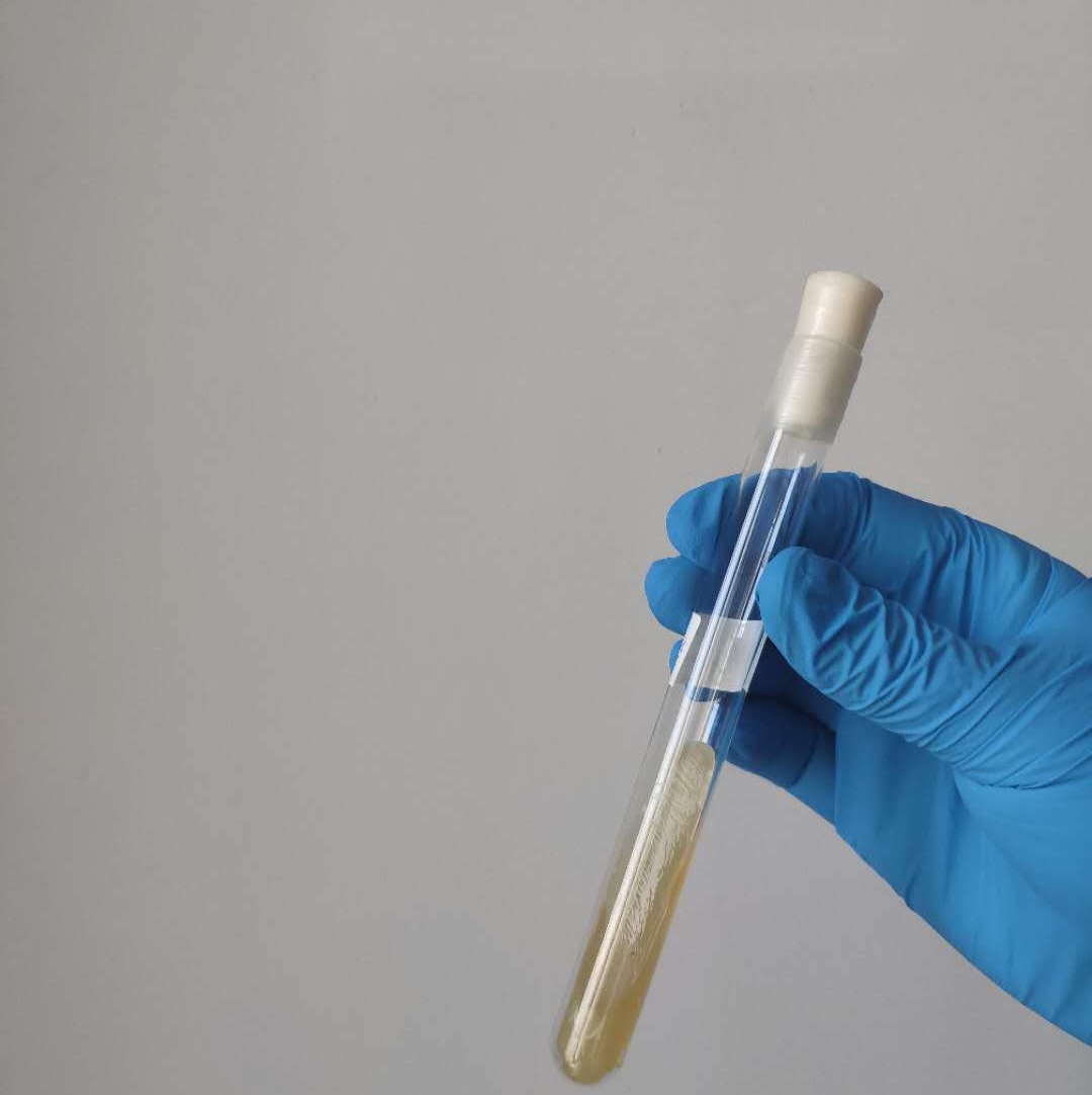 西安免费捐卵，西安免费孕前检查项目有哪些呢